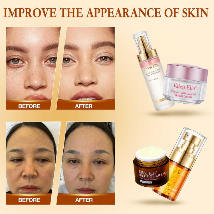 Top cost-effective combo - 24Hour Complete SKIN CARE Partner-8X WHITENING&4X ANTI-AGING-4PCS ONLY ₱1999-SAVE ₱2000-UP TO 50% OFF - Limited Time！